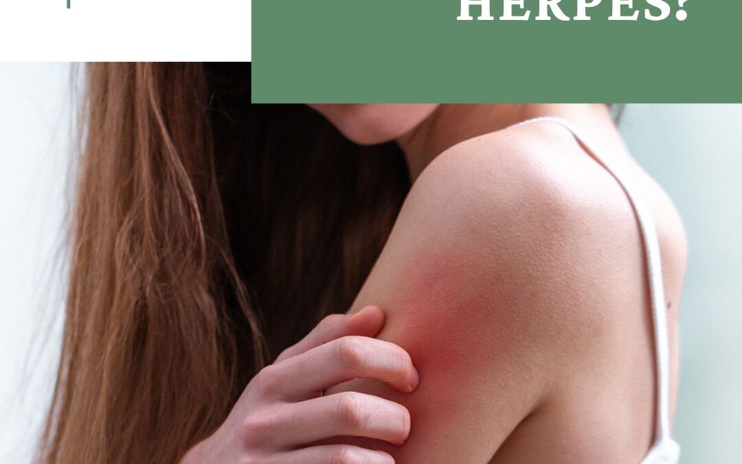 Herpes – was ist Herpes?